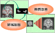 図３／画像解析技術のいろいろ 